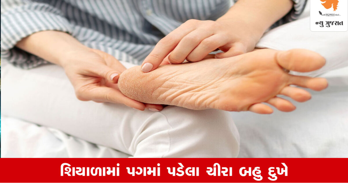 Cracked Heels: શિયાળામાં પગની એ ખૂણાનીચીરોને આ રીતે મટાડી શકો છો, અને મળશે આરામ