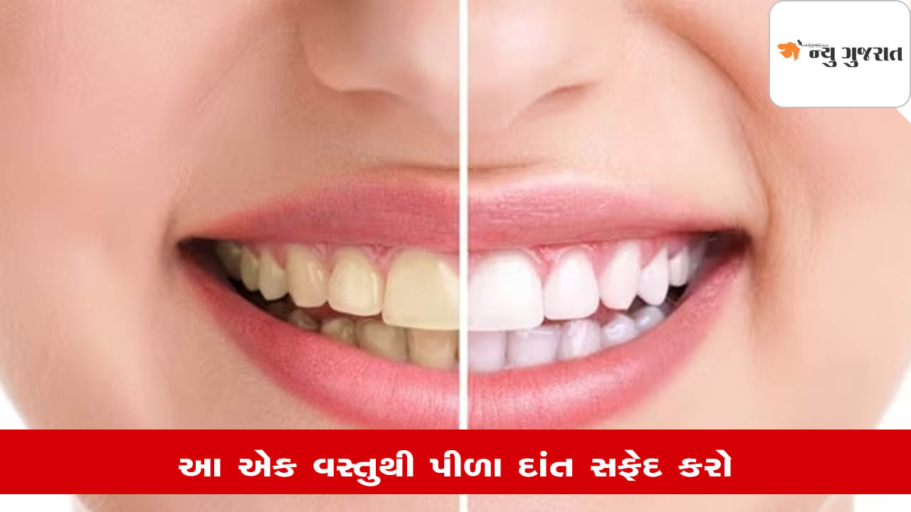 Tips: રસોડામાં પડેલી માત્ર એક વસ્તુથી દાંતની પીળાશ દૂર કરો, અજમાવો ટ્રીક