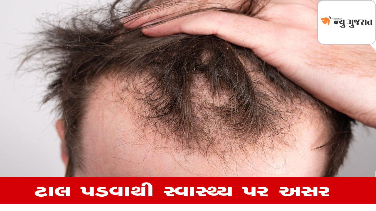 Health: યુવાન અવસ્થામાં ટાલ પડવાની સમસ્યાથી કેવી રીતે બચવું?