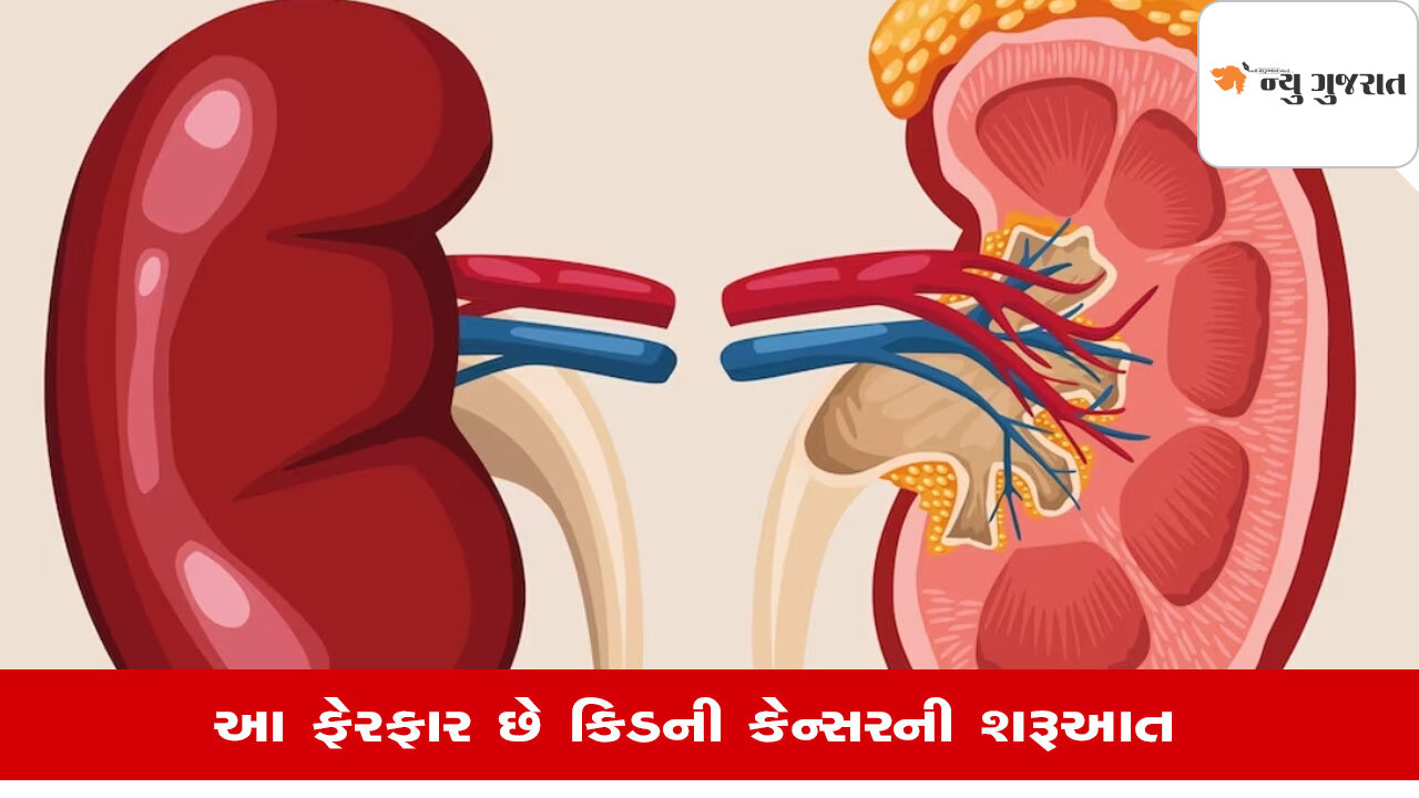 Lifestyle: Kidney Cancerના આ છે લક્ષણો, તાત્કાલિક કરાવો પરીક્ષણ