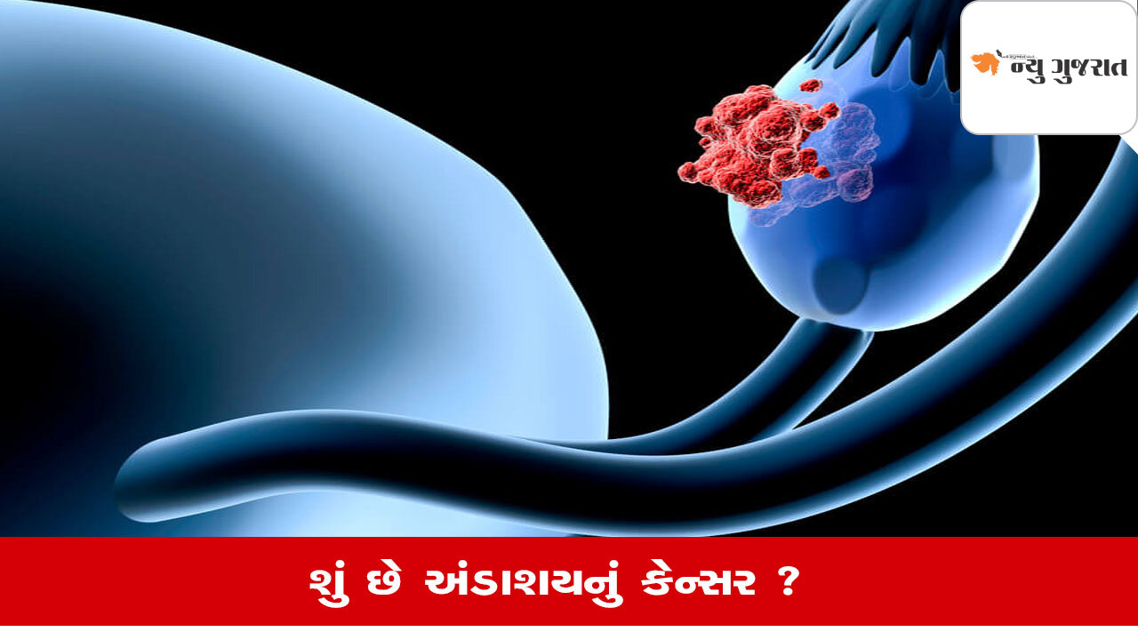 World Ovarian Cancer Day 2025: અંડાશય કેન્સર બાબતે મહિલાઓમાં જાગૃત્તિ લાવવી જરુરી