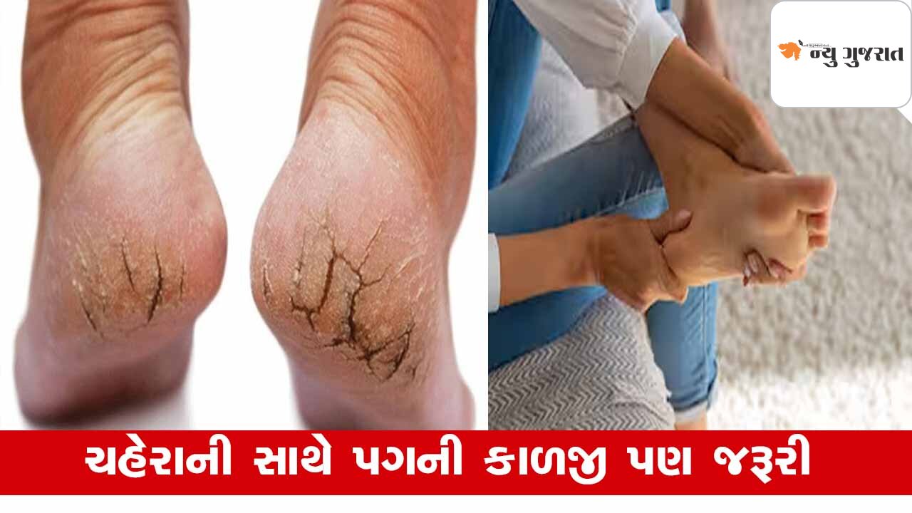 Tips : ગરમીમાં મહિલાઓમાં કેમ પગમાં વાઢિયાની સમસ્યા, દાદીના નુસખા આપશે લાભ
