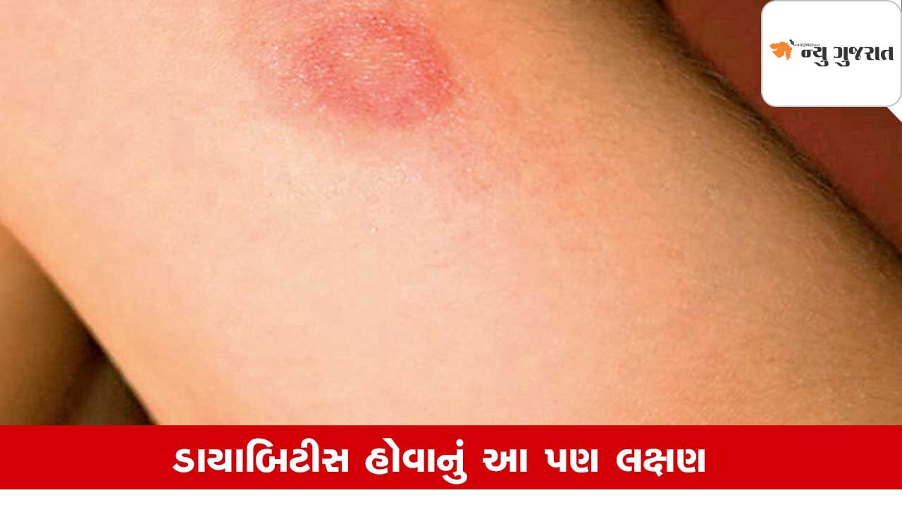 Symptoms of Diabetes: ત્વચામાં દેખાય આ ફેરફાર, તો થઇ જજો સાવધાન