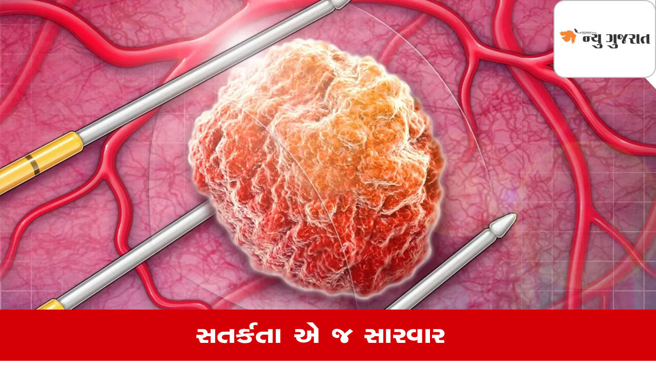 Prostate Cancer કેટલું ઘાતક, શું કહે છે તબીબ, કેવી હોય છે સારવાર?