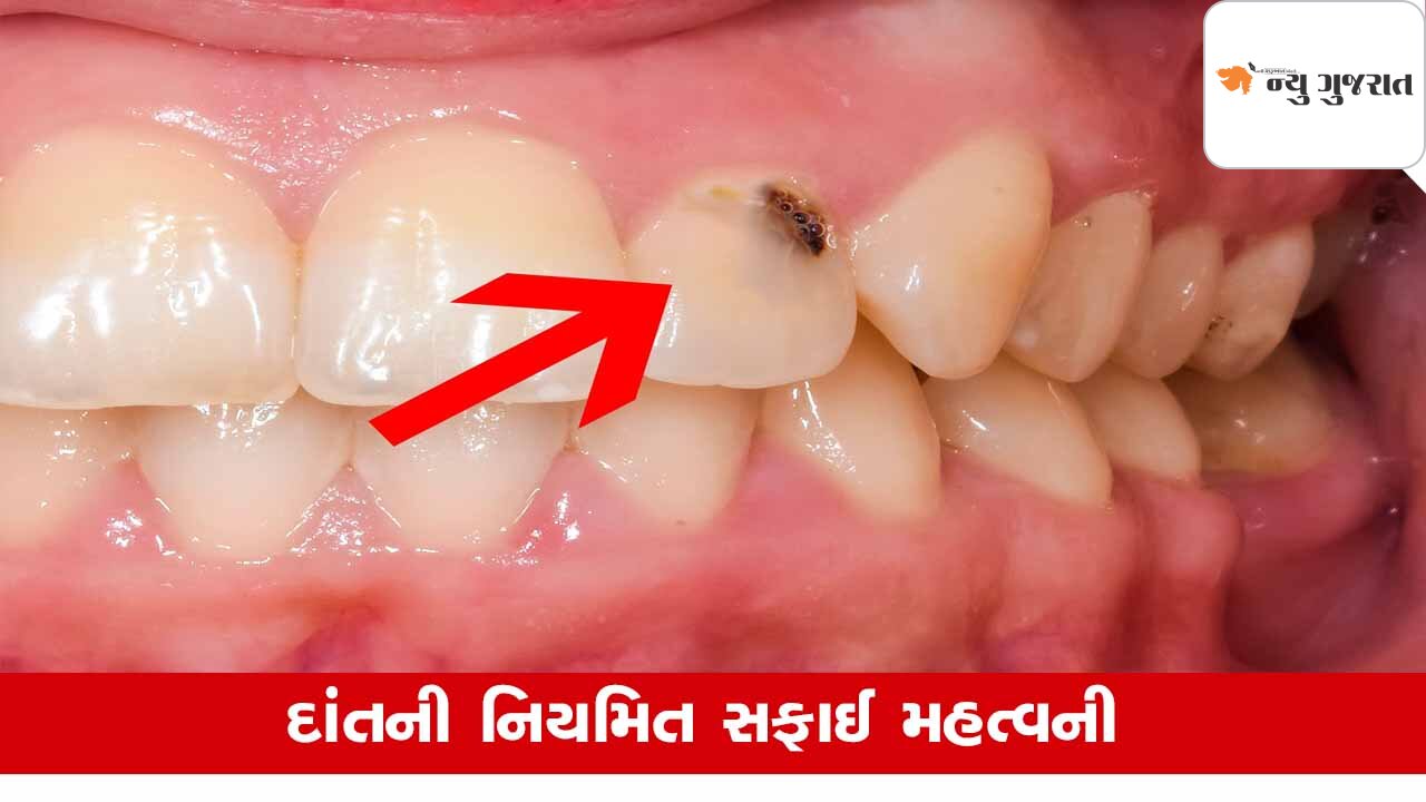 Health : દાંતનો દુખાવો અને સડો કેવી રીતે દૂર કરવો, Try Tips