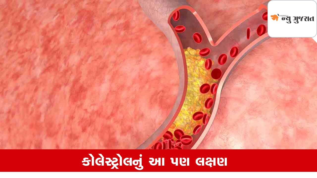 Cholesterol Symptoms: સ્કિનમાં આવે છે આ બદલાવ તો ચેતી જજો