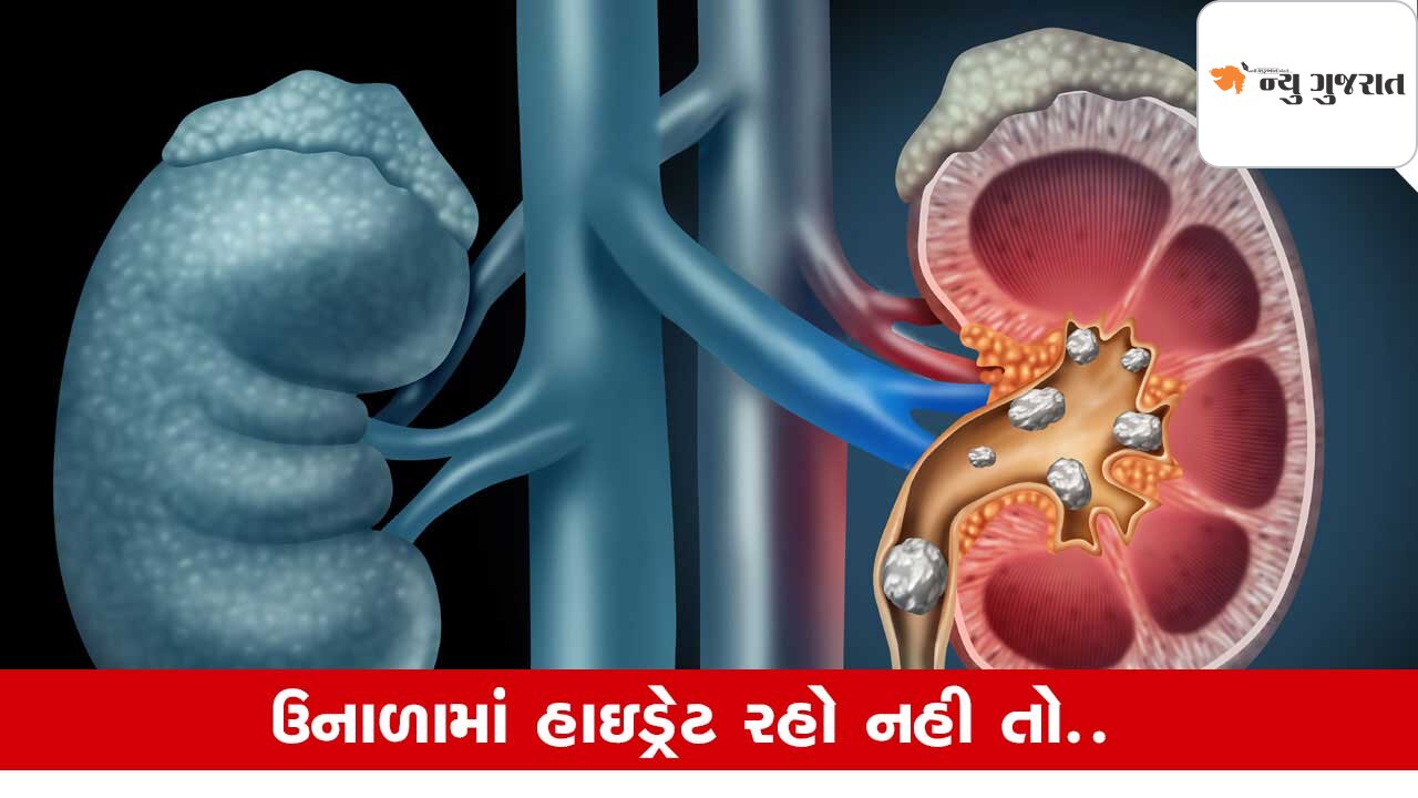 Kidney Stones: ઉનાળામાં કેમ વધી જાય છે પથરીની સમસ્યા? રાખો ધ્યાન