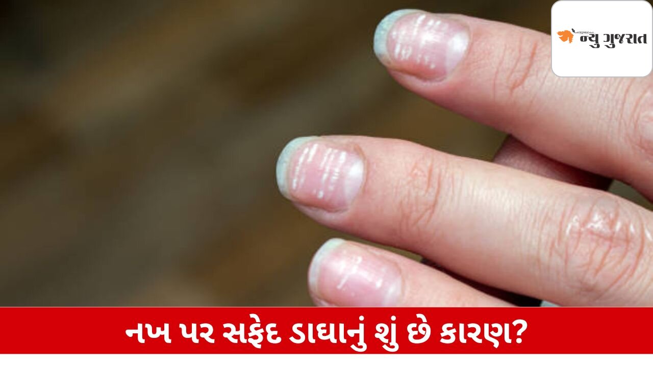 Lifestyle: નખ પર સફેદ ડાઘ કેમ થાય છે? જાણો