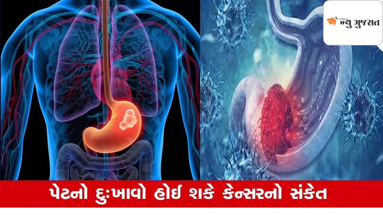Health: પેટના સામાન્ય દુખાવાની સમસ્યાની અવગણના પડી શકે ભારે, પેટ કેન્સરનું જોખમ