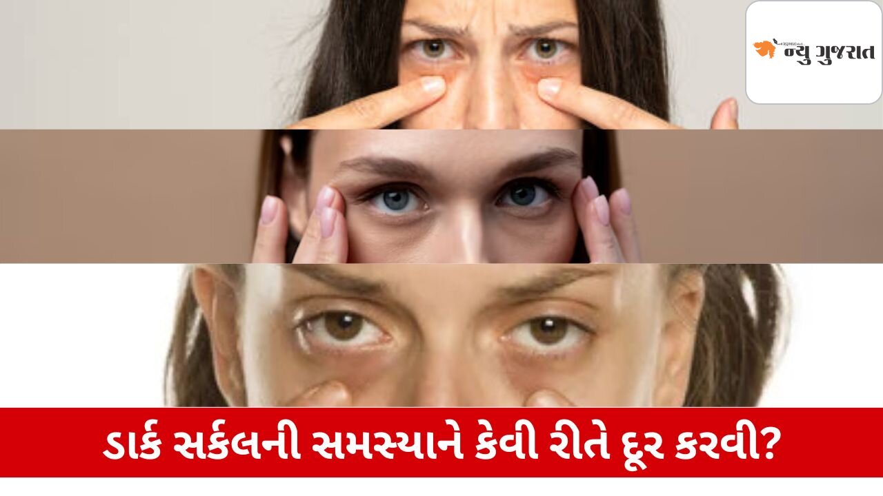 Lifestyle: આંખો પર આ વસ્તુઓ લગાવવાથી દૂર થશે ડાર્ક સર્કલ