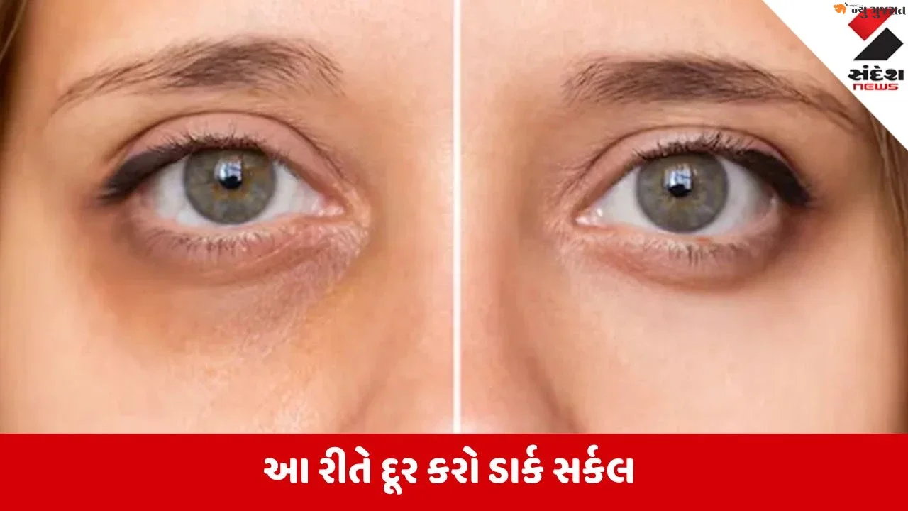 Dark Circle: કાચી હળદર છે રામબાણ ઈલાજ, આંખ નીચેના કાળા કુંડાળા થોડાક દિવસોમાં થશે છુમંતર