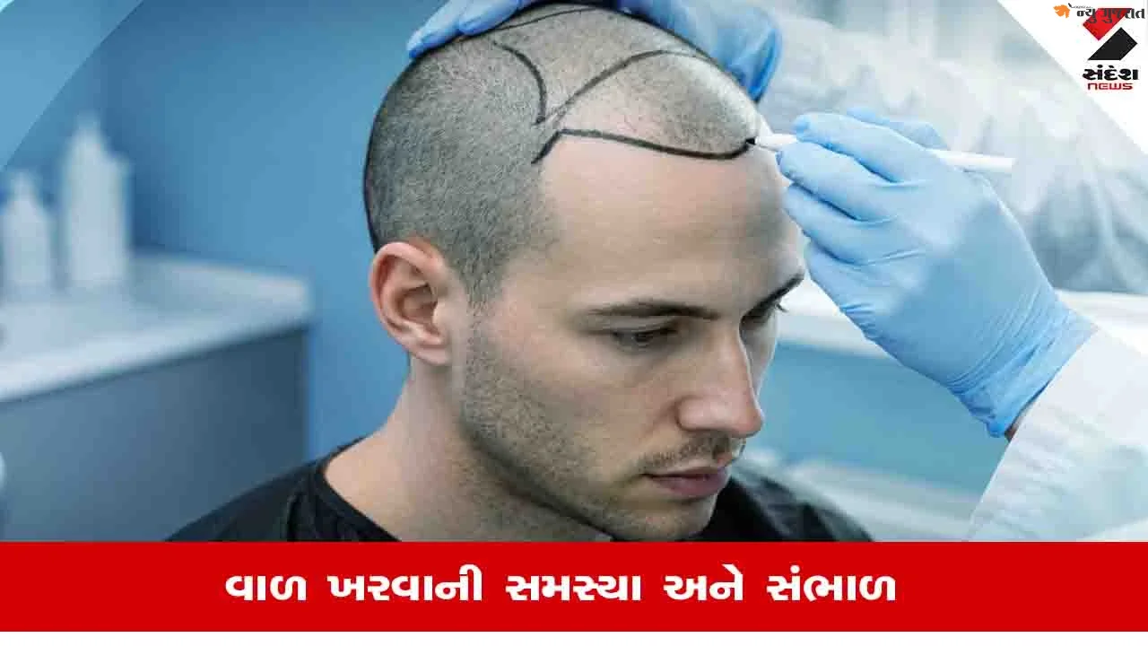 Hair Transplant Side Effects: હેર ટ્રાન્સપ્લાન્ટ કરાવતા પહેલા જાણી લો તેના સાઈડ ઈફેક્ટ્સ